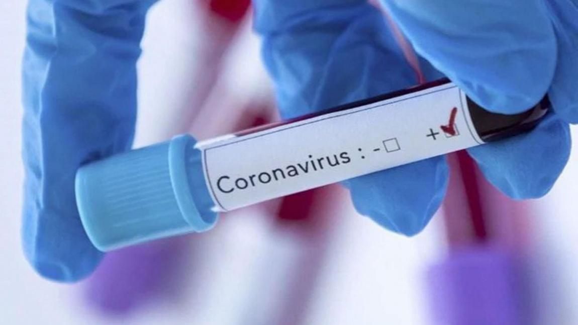 Corana Virüs (Covid-19)